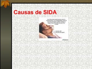 Causas de SIDA 