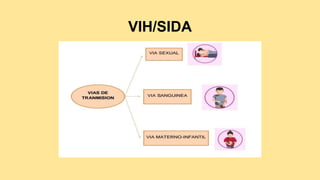 VIH/SIDA
 