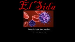 El Sida
Esveidy González Medina.
Marzo del 2014
 