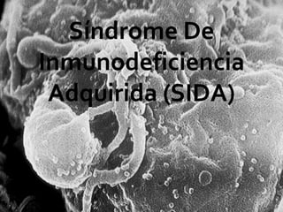Síndrome De Inmunodeficiencia Adquirida (SIDA) 