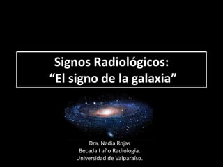 Signos Radiológicos:
“El signo de la galaxia”
Dra. Nadia Rojas
Becada I año Radiología.
Universidad de Valparaíso.
 