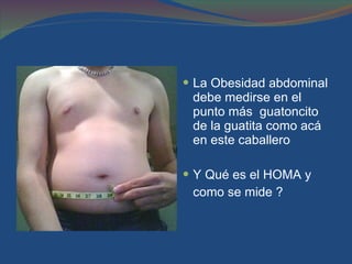 La Obesidad abdominal debe medirse en el punto más  guatoncito de la guatita como acá en este caballero  Y Qué es el HOMA y  como se mide ? 