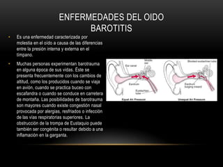 Es una apertura en la membrana timpánica (tímpano).El tímpano también actúa como una barrera que evita que los materiales externos, como las bacterias, penetren en el oído medio, pero cuando está perforado, las bacterias viajan con facilidad hasta el oído medio causando una infección.Los daños al tímpano pueden ocurrir a consecuencia de un trauma acústico, por una lesión directa o por unbarotrauma (daño provocado por presión). La inserción de aplicadores con puntas de algodón o de objetos pequeños (objetos extraños) en el oído para limpiarlo algunas veces provoca la perforación del tímpano.ENFErMEDADESDEL OIDO  RUPTURA DEL TIMPANO