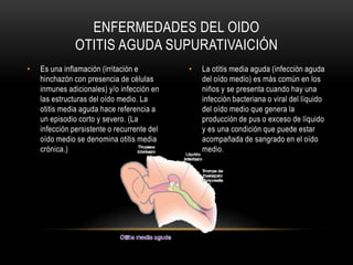 Es una enfermedad caracterizada por molestia en el oído a causa de las diferencias entre la presión interna y externa en el tímpano.Muchas personas experimentan barotrauma en alguna época de sus vidas. Éste se presenta frecuentemente con los cambios de altitud, como los producidos cuando se viaja en avión, cuando se practica buceo con escafandra o cuando se conduce en carretera de montaña. Las posibilidades de barotrauma son mayores cuando existe congestión nasal provocada por alergias, resfriados o infección de las vías respiratorias superiores. La obstrucción de la trompa de Eustaquio puede también ser congénita o resultar debido a una inflamación en la garganta.ENFErMEDADESDEL OIDOBAROTITIS