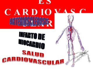 ENFERMEDADES CARDIOVASCULARES 