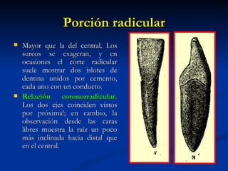 Porción radicular
   Mayor que la del central. Los
    surcos se exageran, y en
    ocasiones el corte radicular
    suele mostrar dos islotes de
    dentina unidos por cemento,
    cada uno con un conducto.
   Relación coronorradicular.
    Los dos ejes coinciden vistos
    por próxima!; en cambio, la
    observación desde las caras
    libres muestra la raíz un poco
    más inclinada hacia distal que
    en el central.
 