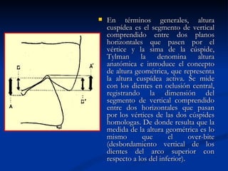    En términos generales, altura
    cuspídea es el segmento de vertical
    comprendido entre dos planos
    horizontales que pasen por el
    vértice y la sima de la cúspide,
    Tylman      la    denomina       altura
    anatómica e introduce el concepto
    de altura geométrica, que representa
    la altura cuspídea activa. Se mide
    con los dientes en oclusión central,
    registrando la dimensión del
    segmento de vertical comprendido
    entre dos horizontales que pasan
    por los vértices de las dos cúspides
    homologas. De donde resulta que la
    medida de la altura geométrica es lo
    mismo        que      el      over-bite
    (desbordamiento vertical de los
    dientes del arco superior con
    respecto a los del inferior).
 