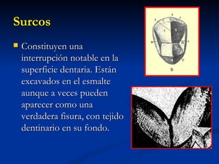 Surcos
   Constituyen una
    interrupción notable en la
    superficie dentaria. Están
    excavados en el esmalte
    aunque a veces pueden
    aparecer como una
    verdadera fisura, con tejido
    dentinario en su fondo.
 