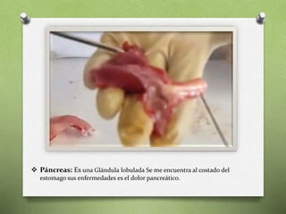  Páncreas: Es una Glándula lobulada Se me encuentra al costado del
estomago sus enfermedades es el dolor pancreático.
 