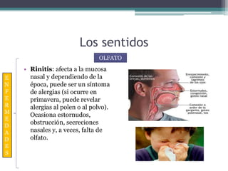 Los sentidos
• Rinitis: afecta a la mucosa
nasal y dependiendo de la
época, puede ser un síntoma
de alergias (si ocurre en
primavera, puede revelar
alergias al polen o al polvo).
Ocasiona estornudos,
obstrucción, secreciones
nasales y, a veces, falta de
olfato.
OLFATO
E
N
F
E
R
M
E
D
A
D
E
S
 