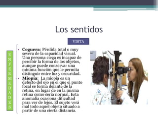 Los sentidos
• Ceguera: Pérdida total o muy
severa de la capacidad visual.
Una persona ciega es incapaz de
percibir la forma de los objetos,
aunque puede conservar una
mínima función que le permita
distinguir entre luz y oscuridad.
• Miopía: La miopía es un
defecto del ojo en el que el punto
focal se forma delante de la
retina, en lugar de en la misma
retina como sería normal. Esta
anomalía ocasiona dificultad
para ver de lejos. El sujeto verá
mal todo aquel objeto situado a
partir de una cierta distancia.
VISTA
E
N
F
E
R
M
E
D
A
D
E
S
 