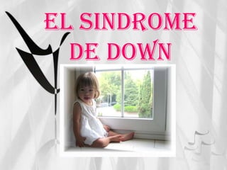 EL SINDROME DE DOWN 