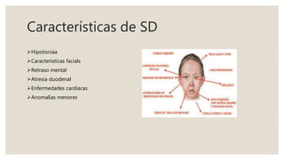 Características de SD
Hipotoníaa
Caracteristicas facials
Retraso mental
Atresia duodenal
Enfermedades cardiacas
Anomalías menores
 