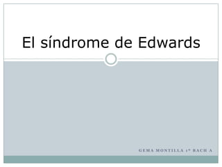 El síndrome de Edwards




              GEMA MONTILLA 1º BACH A
 