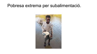 Pobresa extrema per subalimentació.
 