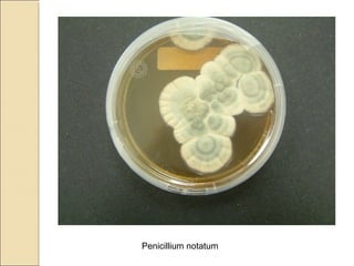 Penicillium notatum
 