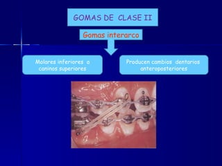 GOMAS DE  CLASE II Molares inferiores  a caninos superiores Producen cambios  dentarios  anteroposteriores Gomas interarco 