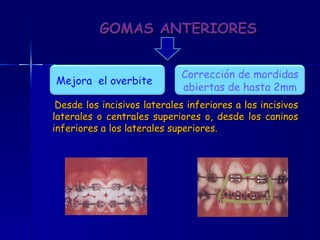 GOMAS ANTERIORES Desde los incisivos laterales inferiores a los incisivos laterales o centrales superiores o, desde los caninos inferiores a los laterales superiores. Mejora  el overbite  Corrección de mordidas abiertas de hasta 2mm 