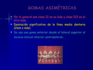 GOMAS ASIMÉTRICAS Por lo general son clase II en un lado y clase III en el otro lado.  Desviación significativa de la línea media dentaria (2mm o más)  Se usa una goma anterior desde el lateral superior al incisivo lateral inferior contralateral . 