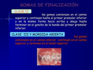 GOMAS DE FINALIZACIÓN las gomas comienzan en el canino superior y continuan hasta el primer premolar inferior y en la misma forma hacia arriba y abajo hasta terminar en el gancho de la banda del primer premolar inferior. las gomas comienzan en el canino inferior  continuan en el canino superior y terminan en el molar superior. CLASE II CLASE  III Y MORDIDA ABIERTA 