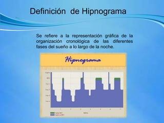 Definición de Hipnograma
Se refiere a la representación gráfica de la
organización cronológica de las diferentes
fases del sueño a lo largo de la noche.
 