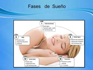 Fases de Sueño
 