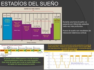 ESTADÍOS DEL SUEÑO
Transición
 