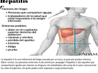 Hepatitis
C
La hepatitis C és una inflamació del fetge causada per un virus, la qual pot produir icterícia,
febre i cirrosi. Les persones amb més ris de contreure i propagar l’hepatitis C són aquelles que
comparteixen agulles per injectar-se drogues i els treballadors del camp de la salut i personal de
les sales d’urgències, els quals poden estar exposats a sang contaminada
 