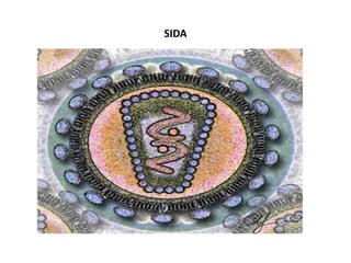 SIDA
 