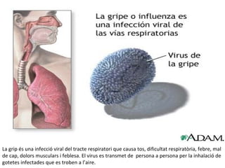 La grip és una infecció viral del tracte respiratori que causa tos, dificultat respiratòria, febre, mal
de cap, dolors musculars i feblesa. El virus es transmet de persona a persona per la inhalació de
gotetes infectades que es troben a l’aire.
 