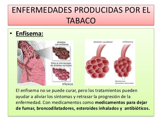 Los esquemas del tratamiento contra el fumar