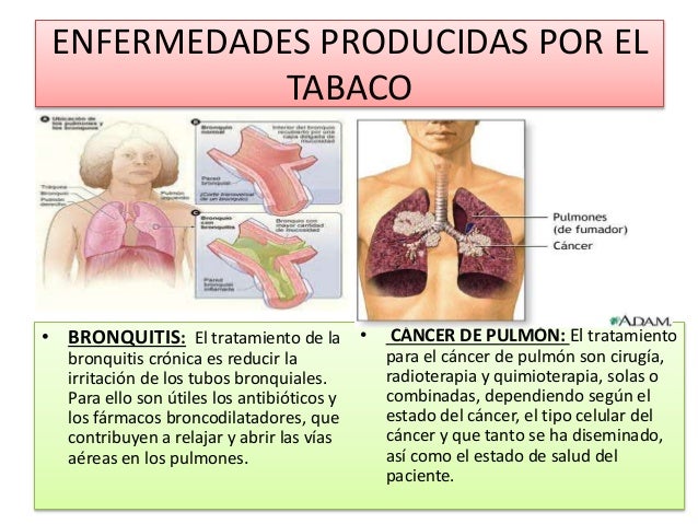 10 Enfermedades Causadas Por El Alcohol Y El Tabaco es.slideshare.net