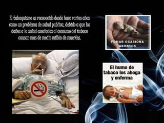 El tabaquismo es reconocido desde hace varios años
como un problema de salud publica, debido a que los
 daños a la salud asociados al consumo del tabaco
      causan mas de medio millón de muertes.
 