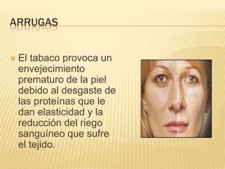 ARRUGAS


   El tabaco provoca un
    envejecimiento
    prematuro de la piel
    debido al desgaste de
    las proteínas que le
    dan elasticidad y la
    reducción del riego
    sanguíneo que sufre
    el tejido.
 