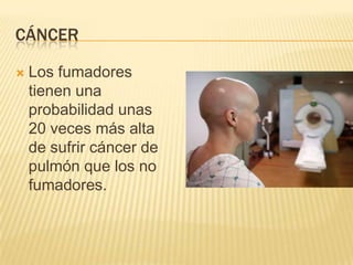 CÁNCER

   Los fumadores
    tienen una
    probabilidad unas
    20 veces más alta
    de sufrir cáncer de
    pulmón que los no
    fumadores.
 