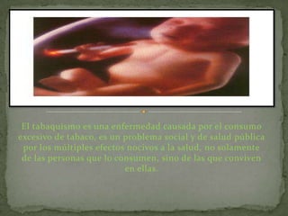 El tabaquismo es una enfermedad causada por el consumo
excesivo de tabaco, es un problema social y de salud pública
 por los múltiples efectos nocivos a la salud, no solamente
 de las personas que lo consumen, sino de las que conviven
                          en ellas.
 