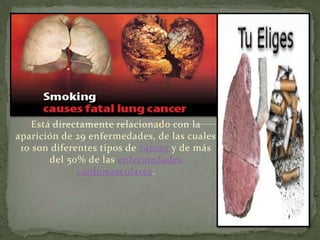 Está directamente relacionado con la
aparición de 29 enfermedades, de las cuales
 10 son diferentes tipos de cáncer y de más
        del 50% de las enfermedades
              cardiovasculares.
 