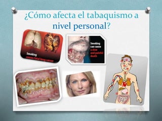 ¿Cómo afecta el tabaquismo a
nivel personal?
 