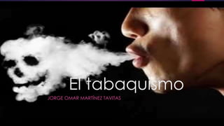 El tabaquismo
JORGE OMAR MARTÍNEZ TAVITAS
 