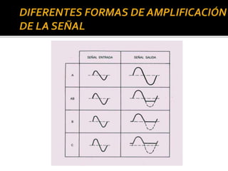 El transistor como amplificador