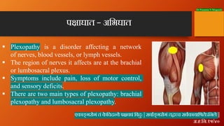 Dr Prasanna N Mogasale
§ Plexopathy is a disorder affecting a network
of nerves, blood vessels, or lymph vessels.
§ The re...