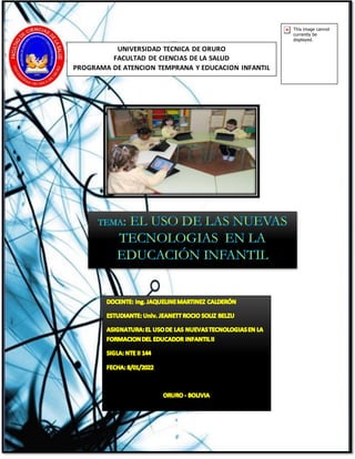 UNIVERSIDAD TECNICA DE ORURO
FACULTAD DE CIENCIAS DE LA SALUD
PROGRAMA DE ATENCION TEMPRANA Y EDUCACION INFANTIL
 