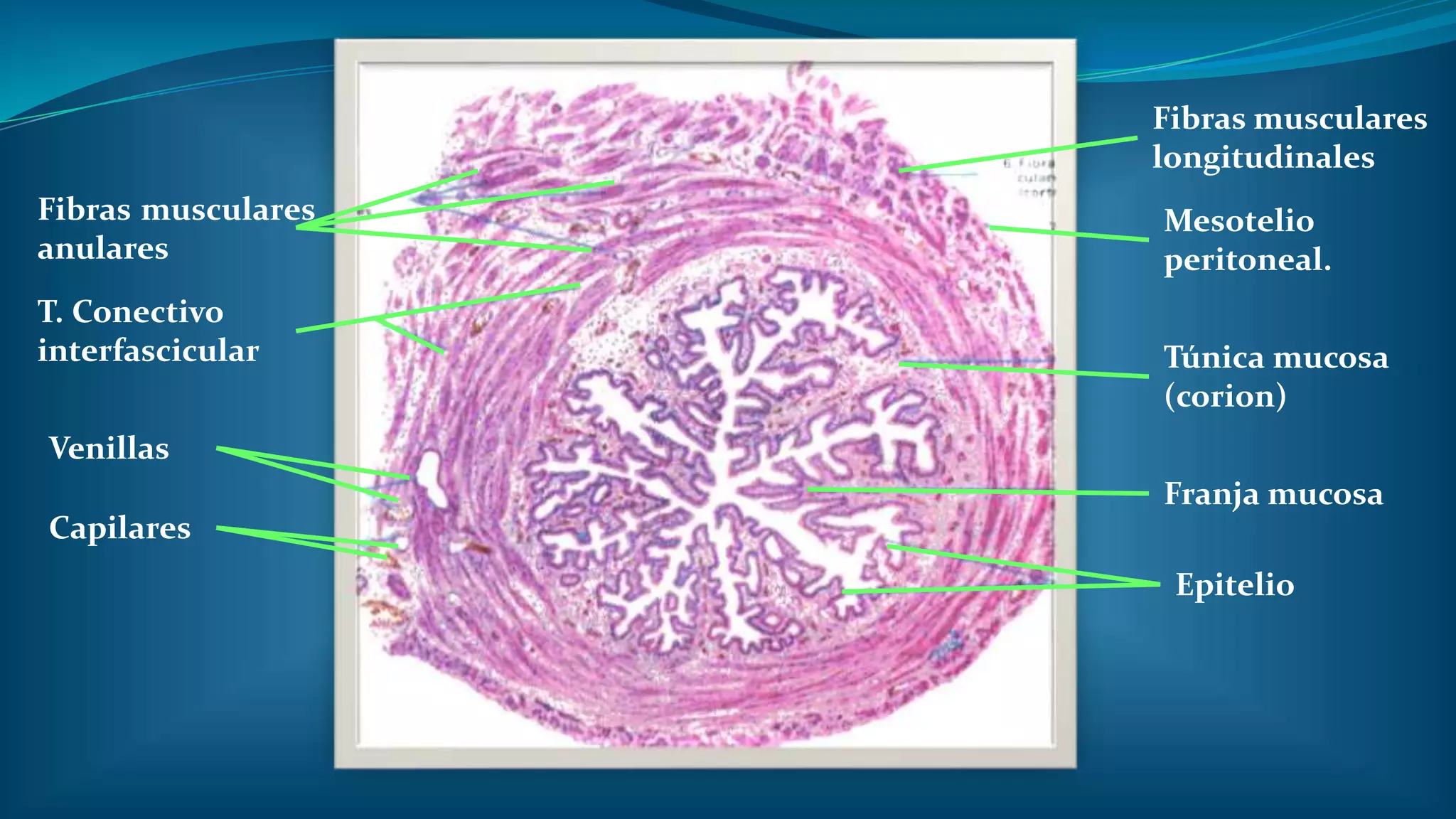 Histologia del Utero, trompas uterinas y Vagina.