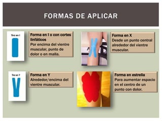 FORMAS DE APLICAR
Forma en I o con cortes
linfáticos
Por encima del vientre
muscular, punto de
dolor o en malla.
Forma en Y
Alrededor/encima del
vientre muscular.
Forma en X
Desde un punto central
alrededor del vientre
muscular.
Forma en estrella
Para aumentar espacio
en el centro de un
punto con dolor.
 