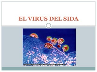 EL VIRUS DEL SIDA 