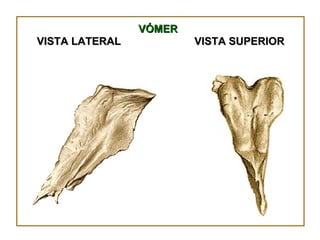 VÓMER VISTA SUPERIOR VISTA LATERAL 