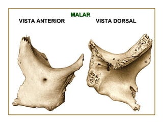 MALAR VISTA DORSAL VISTA ANTERIOR 