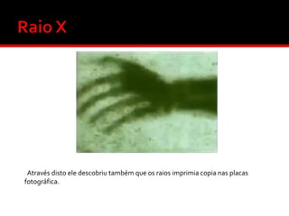 Através disto ele descobriu também que os raios imprimia copia nas placas
fotográfica.

 