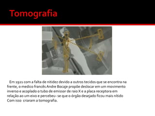 Em 1921 com a falta de nitidez devido a outros tecidos que se encontra na
frente, o medico francês Andre Bocaje propõe deslocar em um movimento
inverso e acoplado o tubo de emissor de raio X e a placa receptora em
relação ao um eixo e percebeu- se que o órgão desejado ficou mais nítido
Com isso criaram a tomografia.

 
