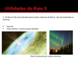  Os Raios X não são produzido apenas pelas máquinas de Raio X , eles são produzido na
natureza.



Pelo Sol
Pelas estrelas e outros corpos celestiais.

Raio X produzido por corpos celestiais

 